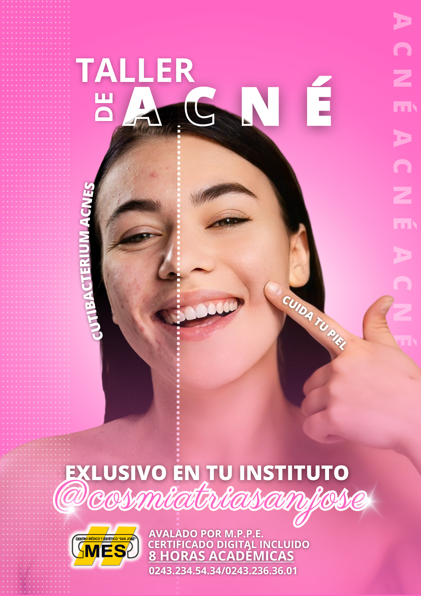 TALLER DE ACNÉ